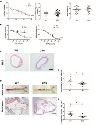 Brahma-Related Gene 1 Deficiency in Endothelial Cells Ameliorates Vascular Inflammatory Responses in Mice